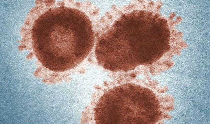 "Banks have a month to prepare before this virus starts starts behaving like an epidemic"